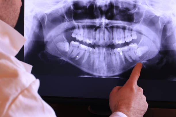 Best Mobile Emergency Dentist in Fairlawn, VA